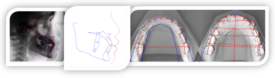 Aligner+ Part II Diagnosis by Consultant