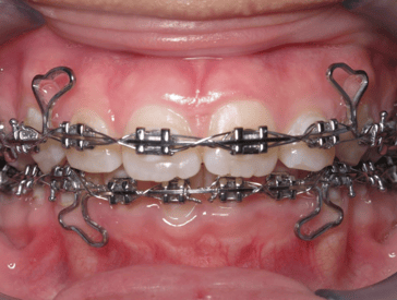 What is the Best Orthodontic Diagnostic Software Tool to Use?