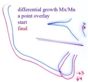 Differential_Growth_Overlay.jpg