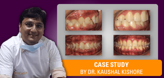 Kaushal Kishore Thankful Case Study Title Image