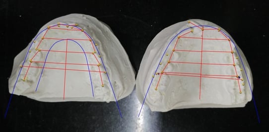 Model Analysis preop-1