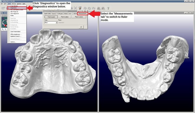 Step 4. Click Measurements tab in OrthoCAD