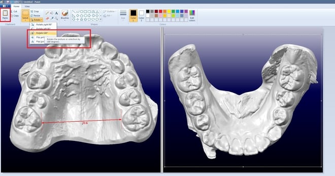 Step 5. Fix orientation of your ortho model