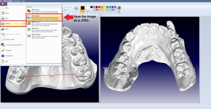 Step 5. Save image as JPEG for double occlusal orientation