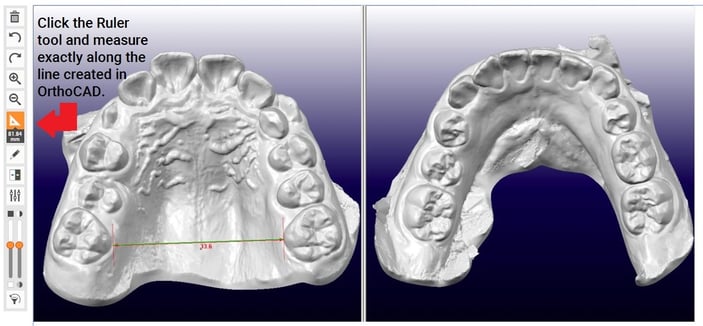 Step 6. Verify measurement of your double occlusal model in SmileStream