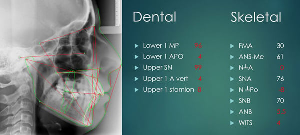 diana-ceph-&-analysis