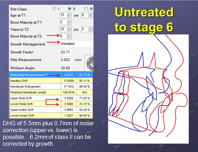 The largest growth study in dentistry was done by...an American general ...