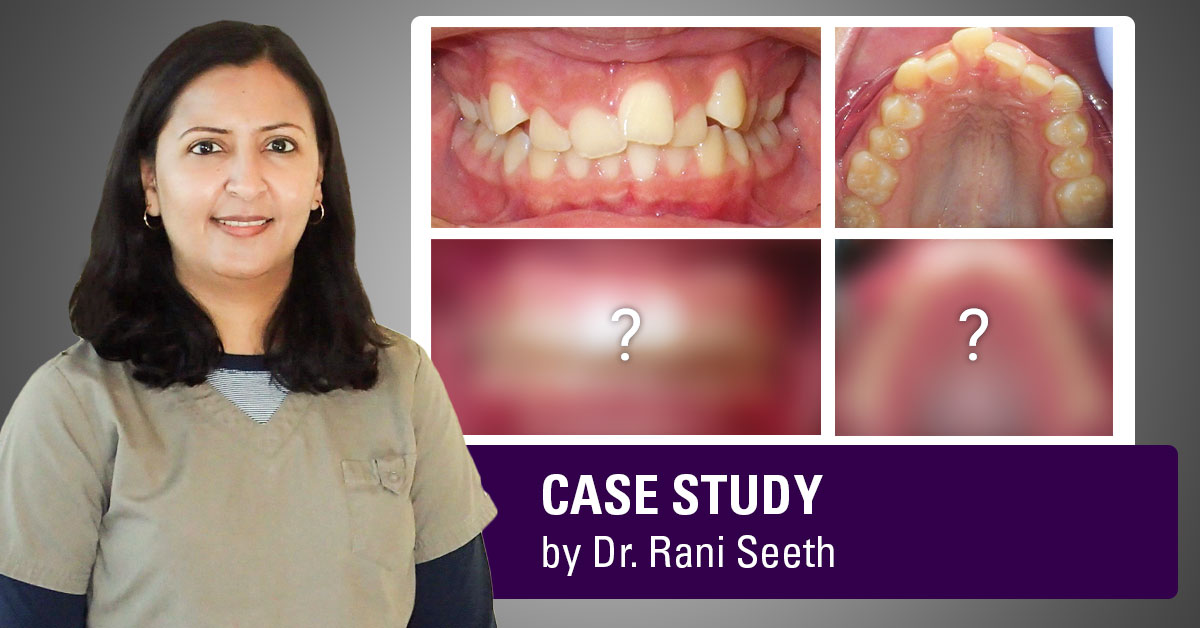 dr-rani-seeth-dds-case-study