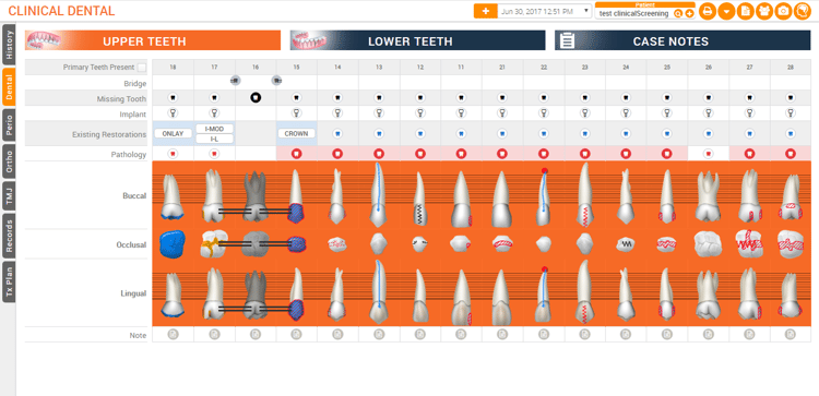 ss-charting+.png