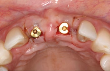step4_esthetic_case.jpg step4_esthetic_case.jpg