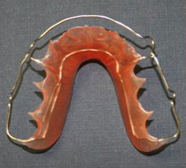 wraparound retainer